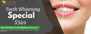 Teeth whitening special
