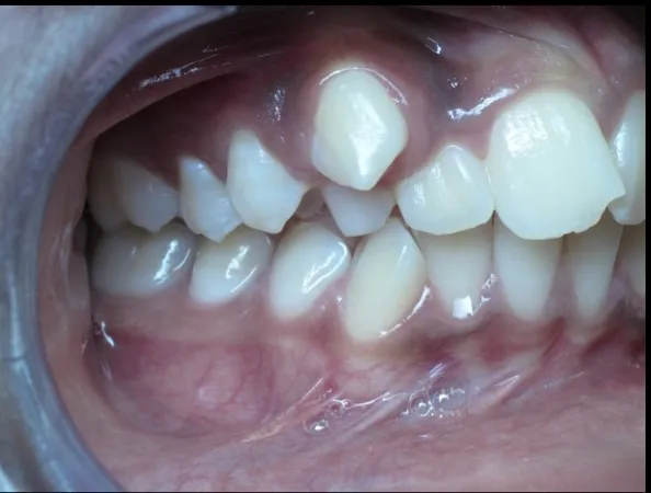 Before Orthodontics